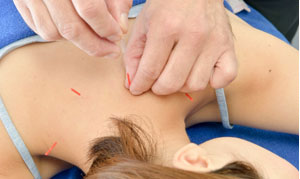 ラポール式鍼灸専門治療