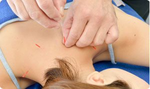 ラポール式鍼灸専門治療